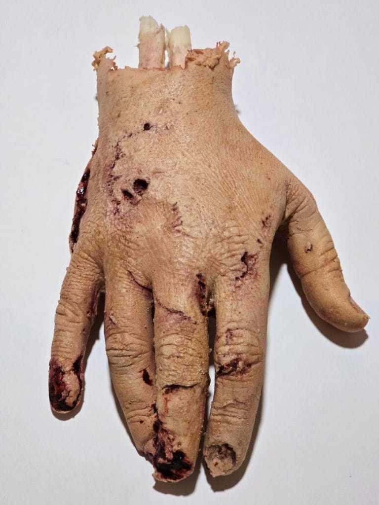 mano destra uomo ferita
