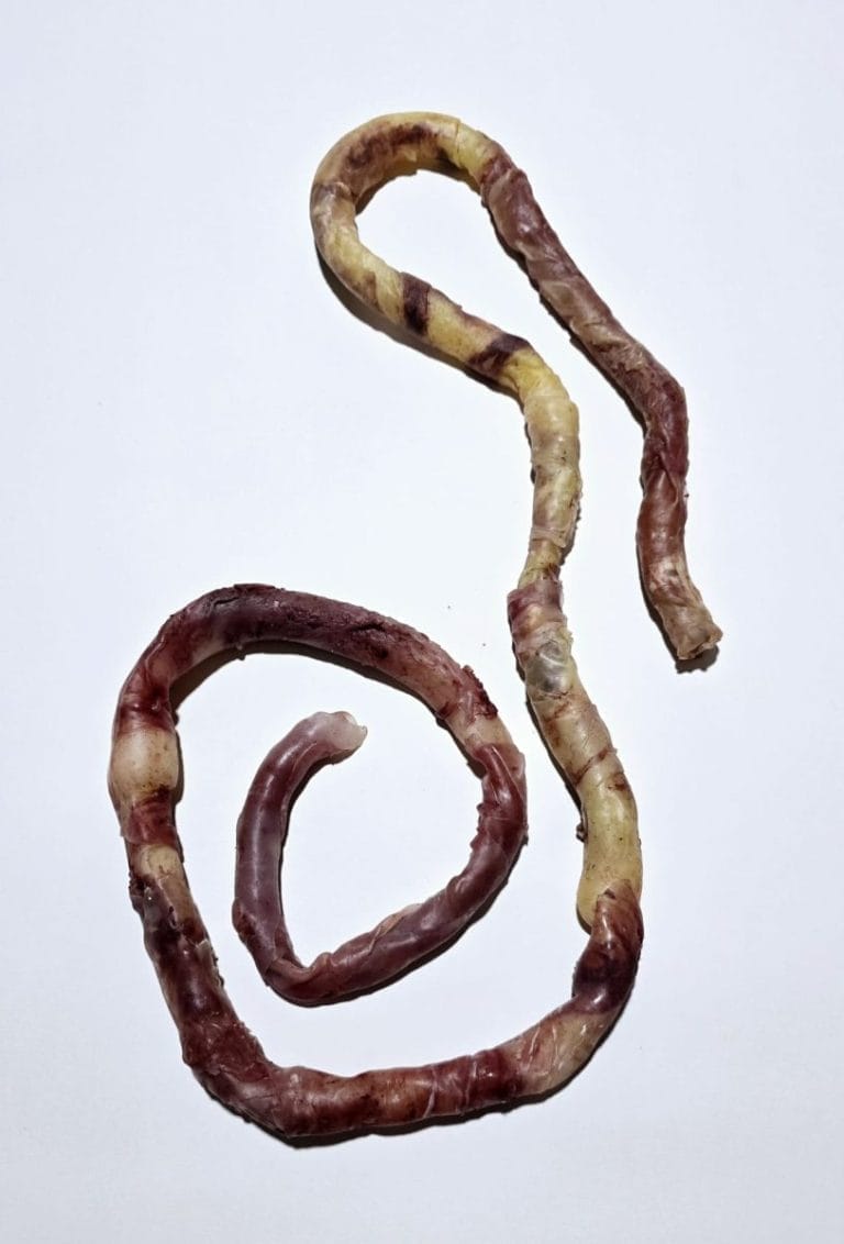 intestino con ernie